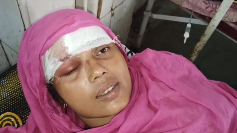 লোনের টাকা চাইতে গিয়ে সংঘর্ষ, হরিশ্চন্দ্রপুরে গুরুতর জখম দলনেত্রী।