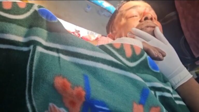 অভিযোগ প্রত্যাহারের চাপের পর নৃশংস হামলা! সংকটজনক ইসরাফিল, তদন্তে পুলিশ।